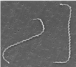 leptospirose infectie